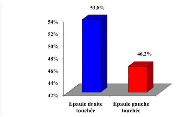 Figure 3: Répartition de nos patients selon le côté atteint. 