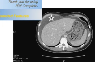 Figure 14. Ascite chyleuse post-surrénalectomie transpéritonéale. 