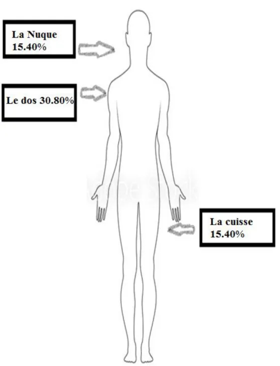 Figure 3 : Différentes localisations des lipomes à cellules fusiformes  
