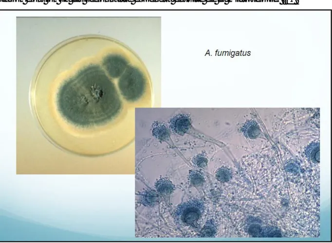 Figure 1 : culture sur une boite de pétri et aspect microscopique : photo de  service de parasitologie de l’HMIMV 