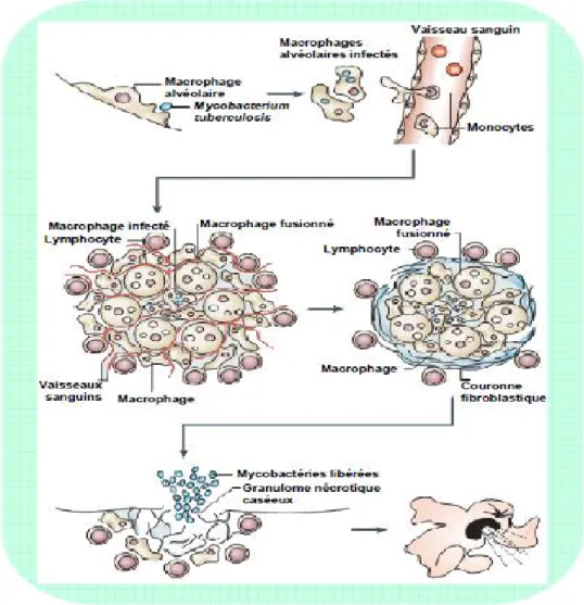 Figure 8 : Formation et progression du granulome lors d’une infection à M. tuberculosis [35] 