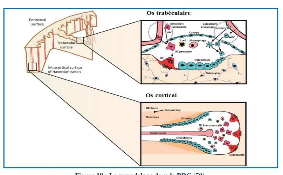 Figure 18 : Le remodelage dans le BRC (50). 