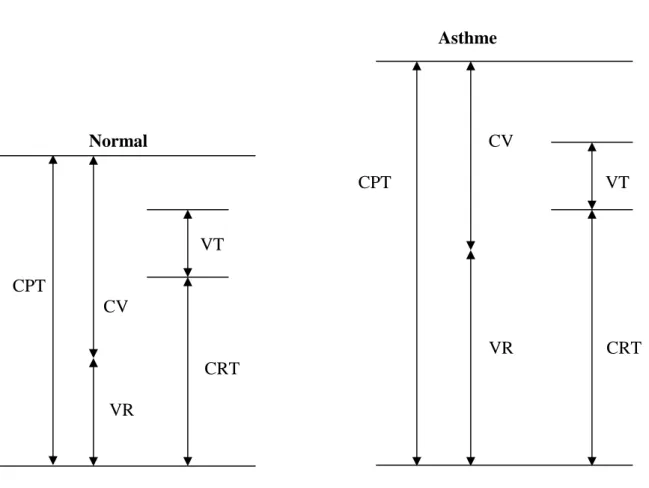 Figure 2 : Les modifications respiratoires au cours de l’asthme aigue grave [90] 