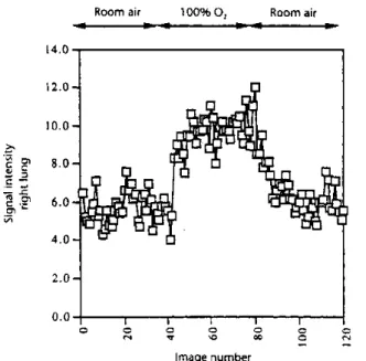Figure 1-22 - imagerie dynamique du poumon par IRM avant puis après administration d'oxygène pur; le signal (unités arbitraires) représenté en fonction du temps se renforce par l'effet paramagnétique de l'oxygène [46 - Edelman 1996].