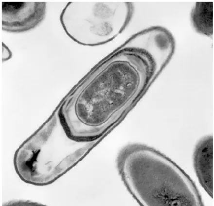 Figure 6 : Endospore de B. subtilis vue au microscope électronique [8]