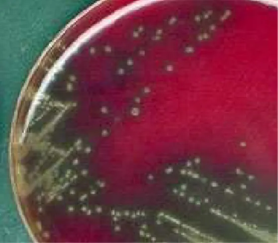 Figure 4  : Aspect de la capsule après coloration de Gram  [4]  Un halot blanchâtre est observable autour des bactéries.
