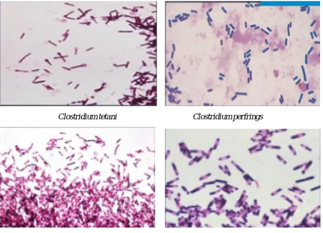 Figure 2: la morphologie des bactéries anaérobies du genre clostridium [17]. 