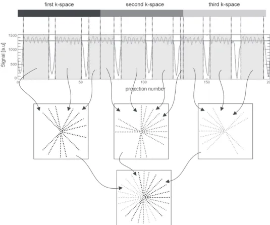 Figure 4.5: Schematic diagram of the retrospective self-getting reconstruction technique.