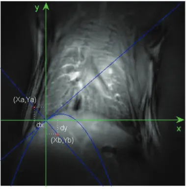 Figure 4.7: Graph showing the algorithm for calculating the line proﬁles. A position of the intensity proﬁle generated and used for the calculation of the image sharpness at the diaphragm position, is shown