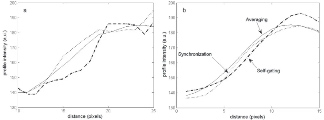 Figure 4.8: Typical proﬁles crossing the diaphragm boarder obtained in the case of no averaging (a) and with 15 averages (b).