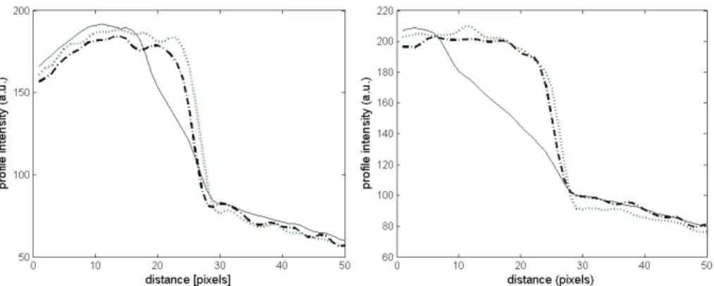 Figure 4.12: Averaged line proﬁles obtained in phantom oscillating with the rate of 30 cycles/min and amplitude of 1.5 mm (left) and the rate of 60 cycles/min and the amplitude of 3 mm (right).