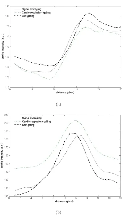 Figure 4.15: Averaged line proﬁles obtained at the diaphram/liver interface (a) and at the edge fo the right pulmonary vessels (b).