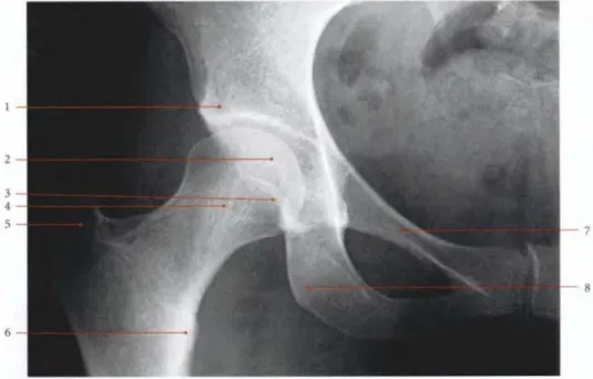 Figure 4: Articulation coxo-fémorale de face (radiographie) 