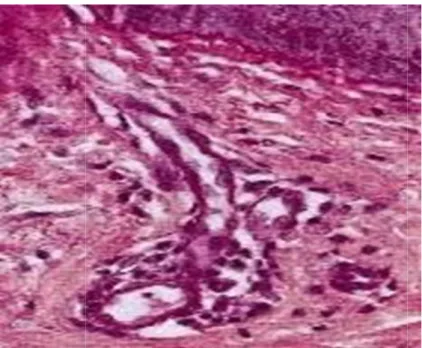 Figure 7 : Coupe histologique montrant la membrane basale dermoépidermique et  capillaire du derme papil