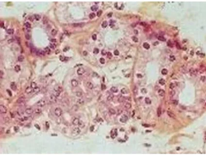 Figure 12 : Glande sudorale eccrine : glomérule sudoripare et début de la partie 