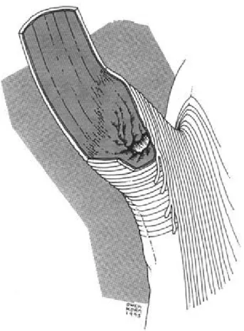 Figure 8: Représentation tridimensionnelle du sphincter du bas œsophage 