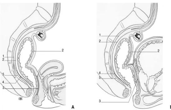 Figure 3  A.  Coupe sagittale du petit bassin chez la femme.  1. Feuillet pariétal du fascia pelvien ; 2