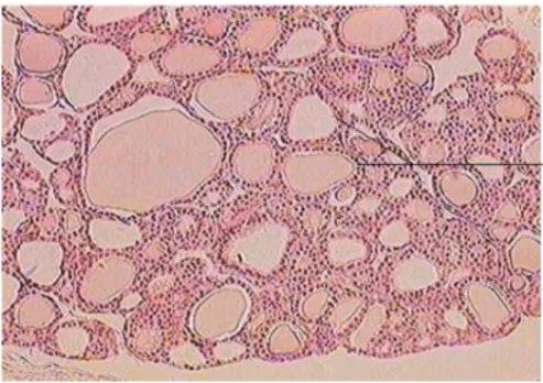 Figure 8: Histologie de la glande thyroïde 
