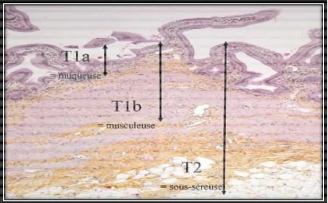 Figure 14 : coupe histologique : représentation des stades T sur une paroi   vésiculaire normale [40] 