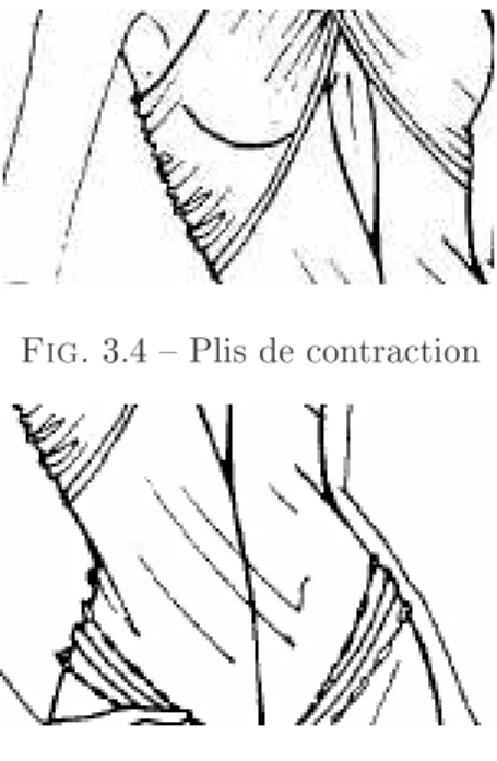 Fig. 3.4  Plis de contraction