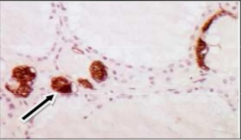 Figure 11 : cellule C en immunohistochmie (Stevens, A., Human Histology) 
