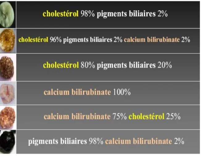 Figure 8: Les différents types de calculs vésiculaires et leur composition. 