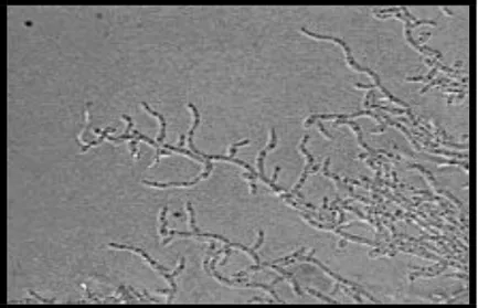 Figure 5 : Morphologie microscopique de Candida parapsilosis  