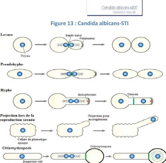 Figure 14 : Les différentes morphologies et la croissance de Candida albicans .