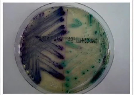 Figure 3: Aspect et couleur des colonies sur milieu chromogène, C.albicans à gauche et  C.glabrata à droite 