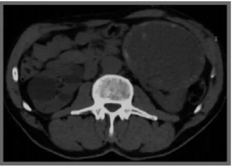 Figure 1 : Scanner abdominal 