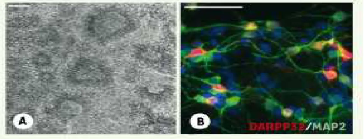 Figure 11 : Différenciation des cellules souches embryonnaires humaines en neurones  striataux