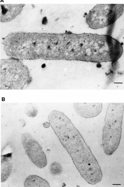 Fig. 2. Detection of tobramycin inside bacterial cells by immunogold labeling. (A) Pseudomonas  aeruginosa 429 incubated 6 h with Fluidosomes