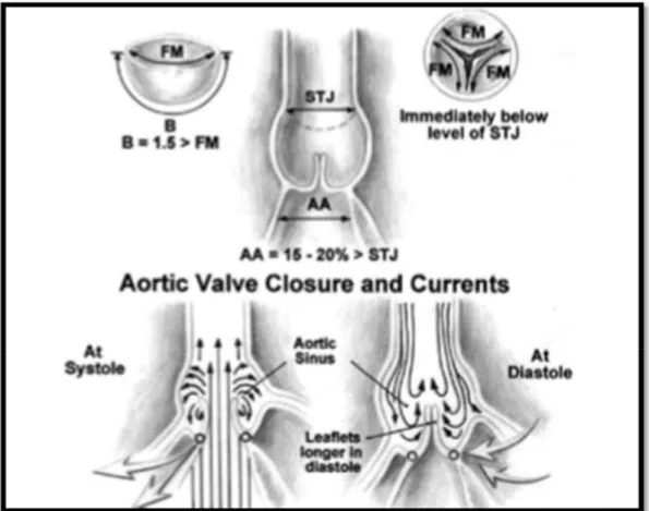 Figure 17 : Schéma illustrant les modifications de forme de la valve aortique  durant le cycle  cardiaque 