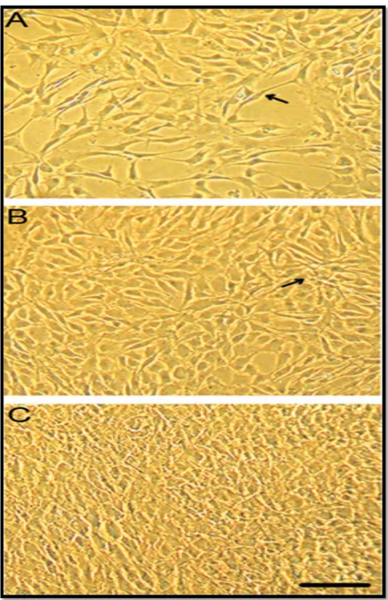 Figure  24  :  Microphotographie  d’une  monocouche  de  VIC  à  différentes  densités :  A :  modérée B :confluente C : très confluentes 