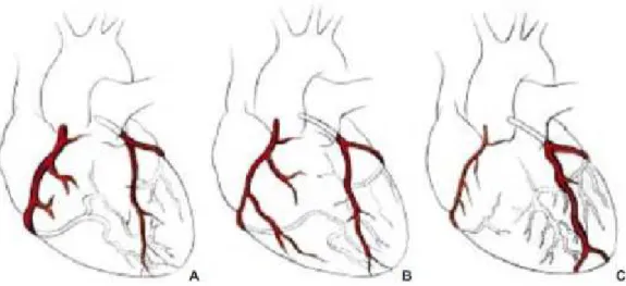Figure 5: Dominance des artères coronaires 