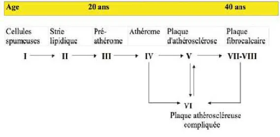 Figure 9 : Les différents stades du processus de l’athérosclérose [24] 