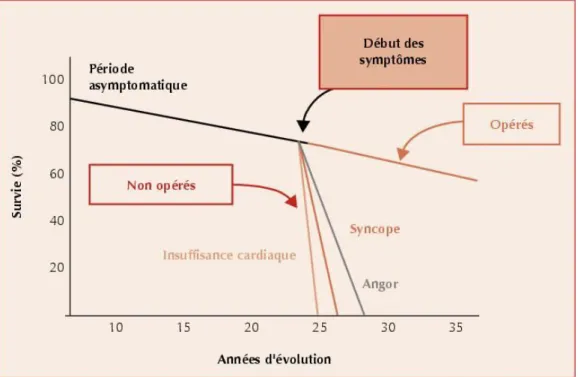 Figure 10: Histoire naturelle de la sténose aortique : survie avant et après apparition des  symptômes chez les patients opérés et non opérés(26)