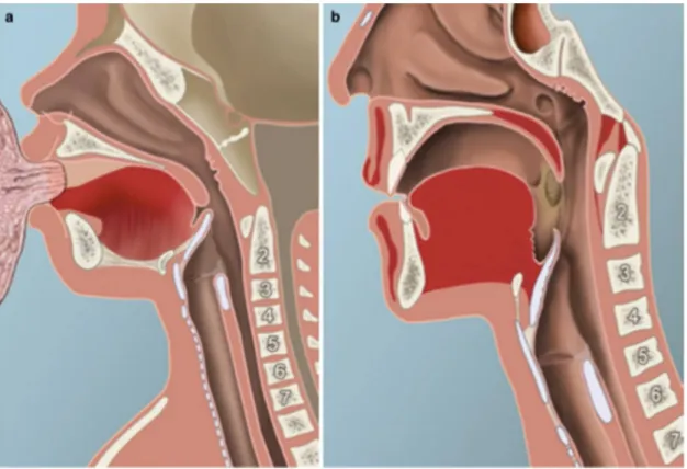 Figure 1 : Coupe sagittale mettant en évidence les larynx du nourrisson et de l’adulte