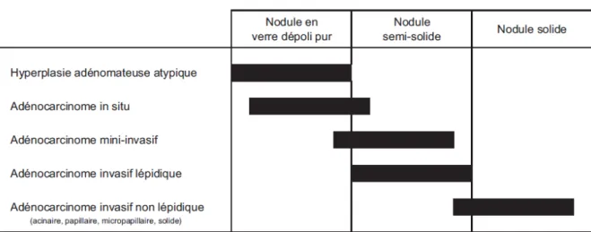 Tableau 4 : Montrant Spectre lésionnel des adénocarcinomes bronchiques. Corrélations  radio-histologiques.( référence  : M