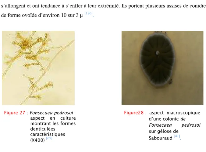 Figure 27 : Fonsecaea pedrosoi :         aspect  en  culture         montrant les formes         denticulées             caractéristiques            (X400)  [65]