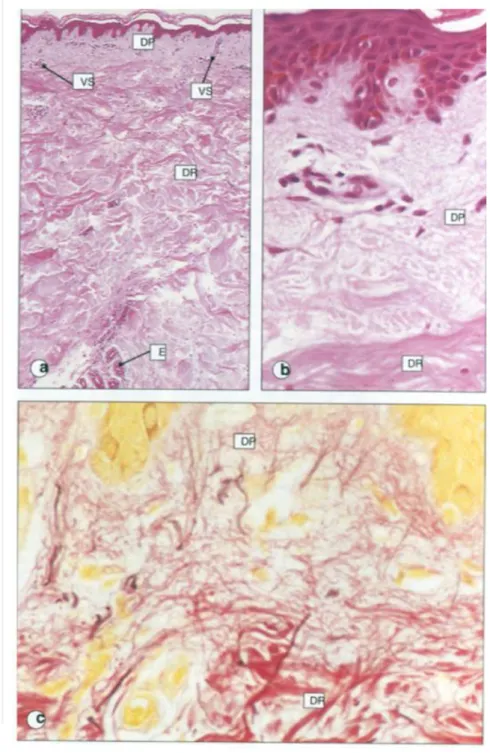 Figure 8 : Histologie du derme. (35) 