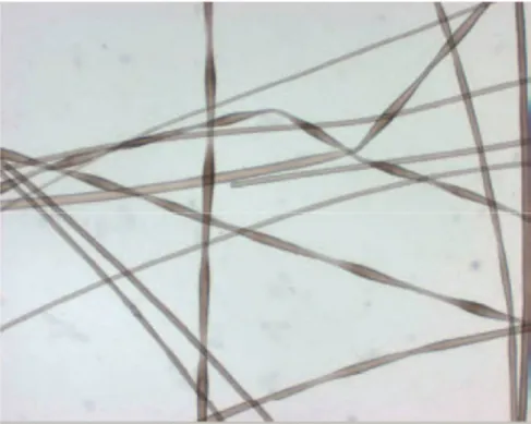 Figure 24: Monilethrix : nodosités uniformes et rétrécissements périodiques internodaux  le long de la tige pilaire en microscopie optique