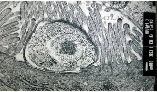 Figure 4 : trophozoite localisé dans la surface de cellule épithéliale intestinale vue en  microscope électronique [89] 