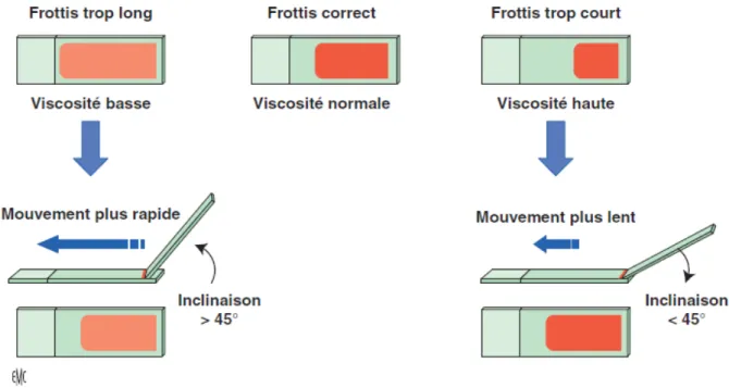 Figure 11. Adaptation de la technique d’étalement à la viscosité du sang [2].  