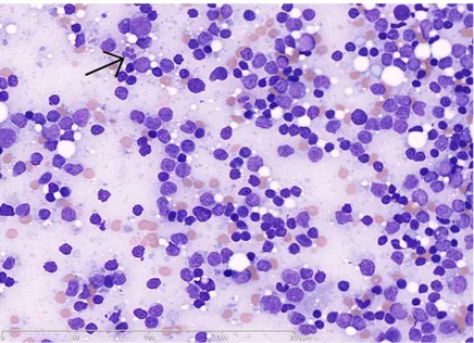 Figure 13. Coloration considérée comme correcte : les hématies sont rose orangé   ou «chamois» et le cytoplasme des polynucléaires est rosé (flèche noire)