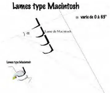 Figure 5 : lames type Macintoch 