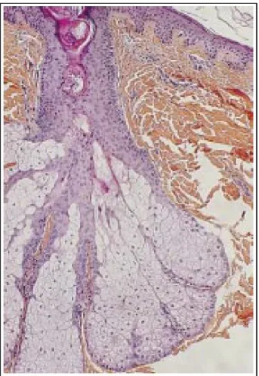 Fig. 9: Glande Sébacée et orifice pilosébacé (HES×100) 