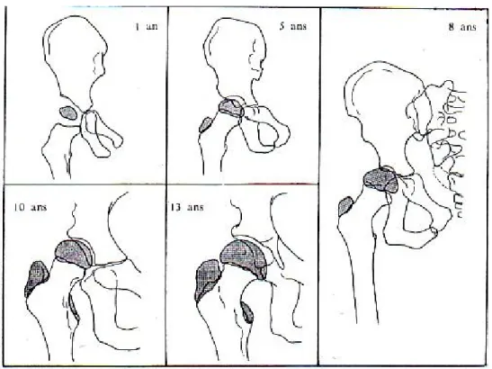 Fig 4 : Développement osseux de l’extrémité supérieure du fémur 