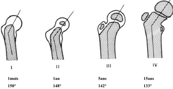 Fig 7 : Evolution de l’angle cervico-diaphysaire selon Von Lanz (12) 