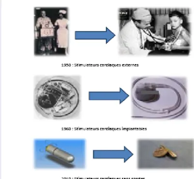 Figure 1 : Etapes marquantes de la stimulation cardiaque [8] . 